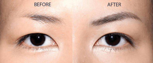 Vì Sao Lông Mày Lại Thưa Dần Theo Thời Gian? Nguyên Nhân & Giải Pháp Từ Serum FEG