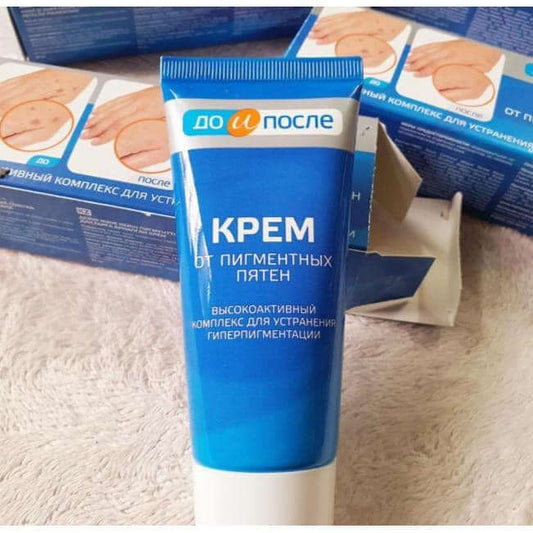 Kem đồi mồi kpem Nga 50ml xóa mờ đồi mồi tay, tàn nhang dưỡng da tay trắng sáng mịn màng