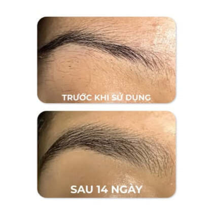 Serum Dưỡng Mày FEG - Nuôi Dưỡng Lông Mày Dài, Dày, Chắc Khỏe Sau 14 Ngày (3ml)