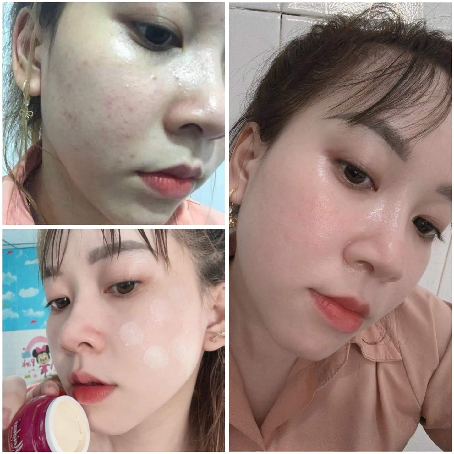 Kem Meiduzi Dưỡng Trắng Da Giảm Nám Hiệu Quả Chính Hãng