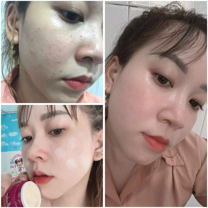 Kem Meiduzi Dưỡng Trắng Da Giảm Nám Hiệu Quả Chính Hãng