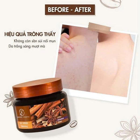 Tẩy Da Chết Toàn Thân Quế Hồi & Cà Phê – Mịn Da, Thơm Lâu